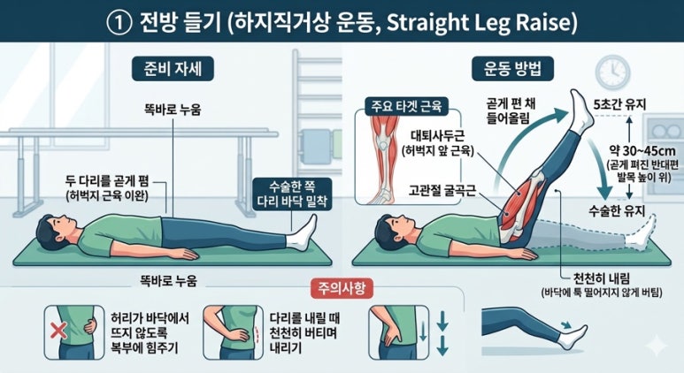 [센터장 브리핑] 무릎 수술 환자를 위한 4방향 고관절 운동 교육 지침 썸네일
