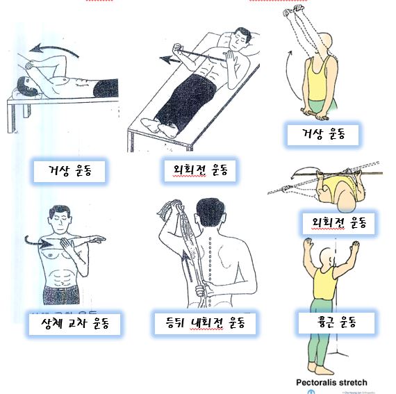 어깨 비수술적 복합 치료 흐름도