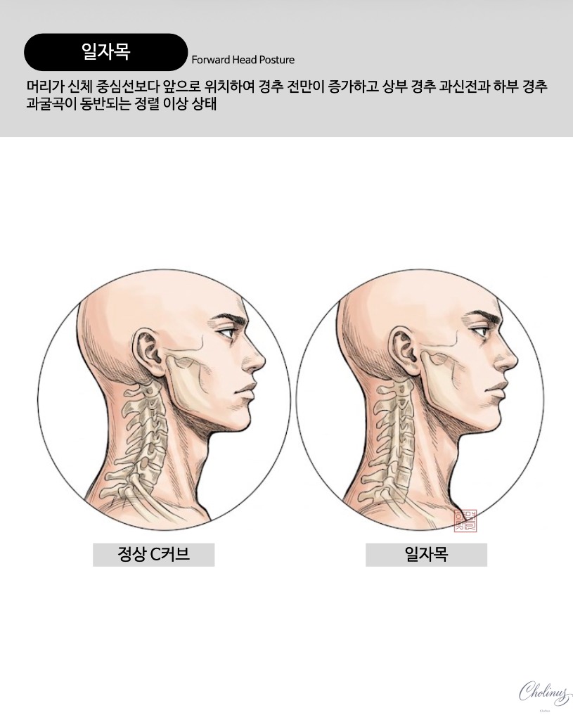 일자목 정렬 해부도