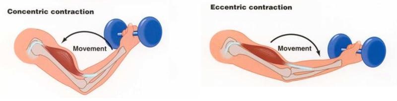 테니스 엘보: Eccentric contraction (신장성 수축 운동) 썸네일